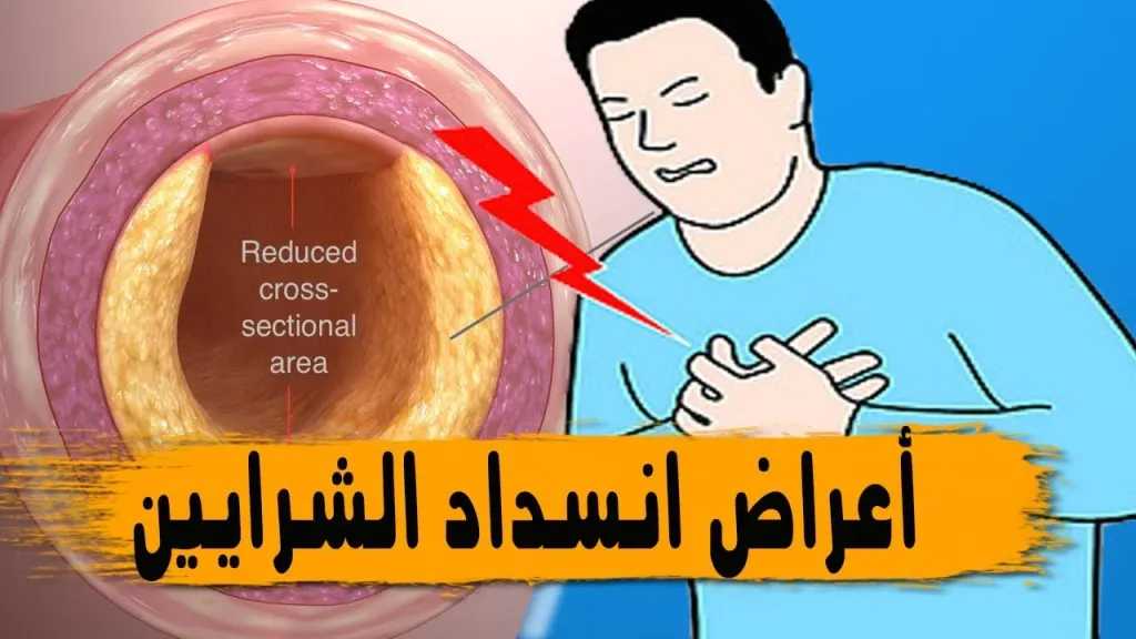 صحة