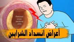 صحة